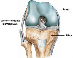 ACL Rupture: Surgical Reconstruction vs Conservative Rehab