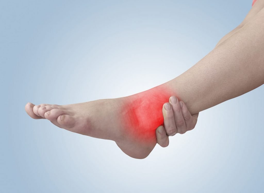 Tendinopathy or Tendonitis | My Physio Perth