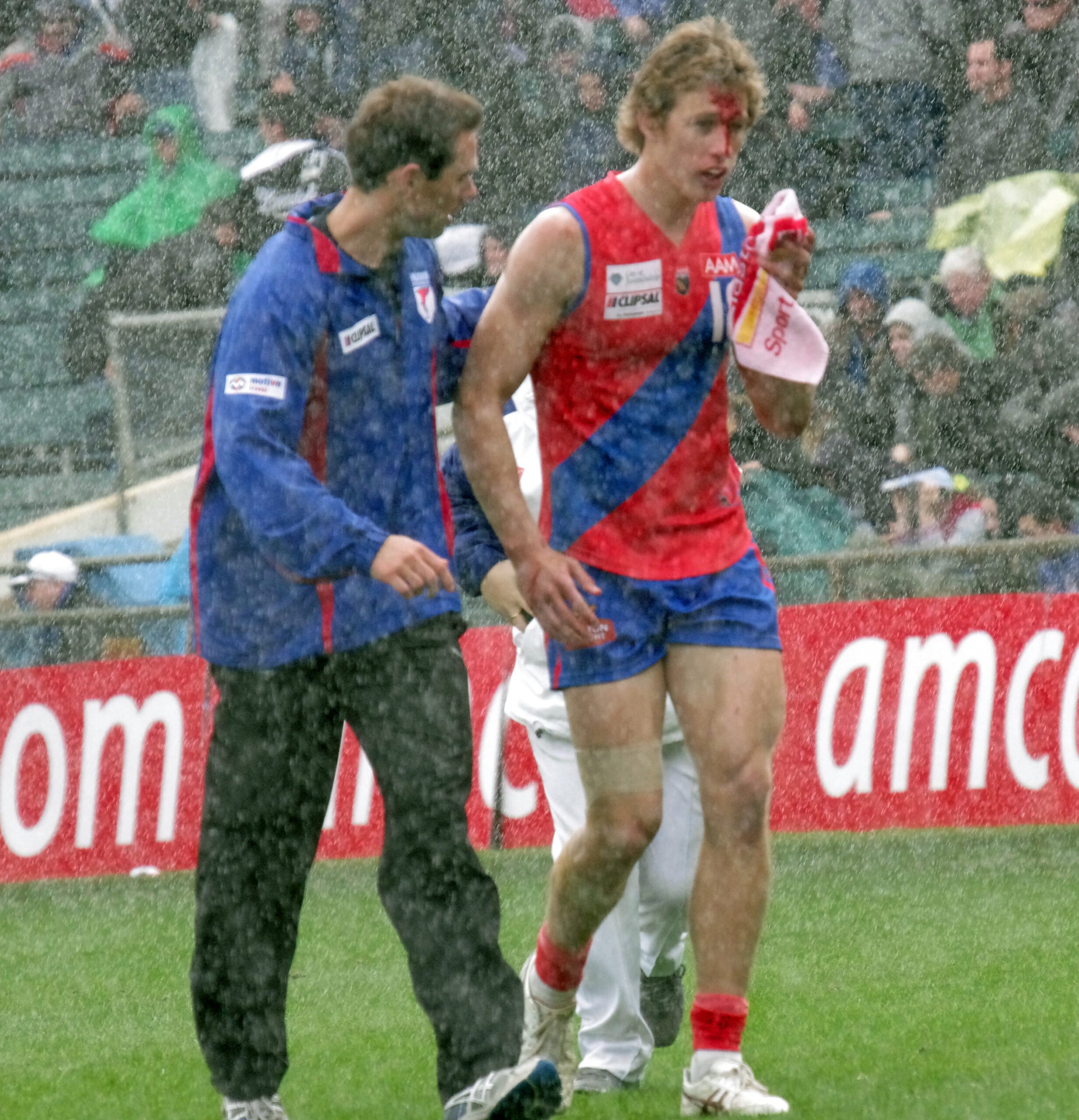 Why See a Sports Physio?